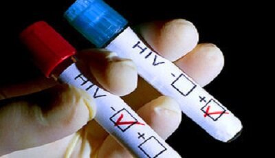 HIV دیگر پایان زندگی نیست، اگر زود تشخیص داده شود